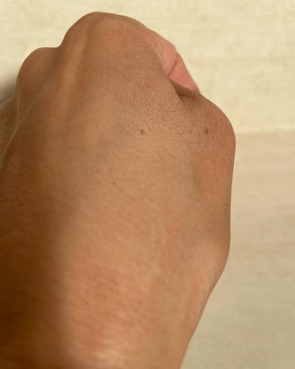 タトゥーウォータープルーフスカーコンシーラー/フォレンコス/リキッドコンシーラーを使ったクチコミ(4枚目)