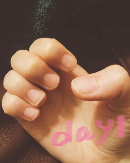 爪美活ネイルオイル/DAISO/ネイルオイル・トリートメントを使ったクチコミ(2枚目)