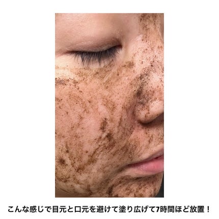 ダーマスキンピーリング/BQCELL/その他キットセットを使ったクチコミ(3枚目)