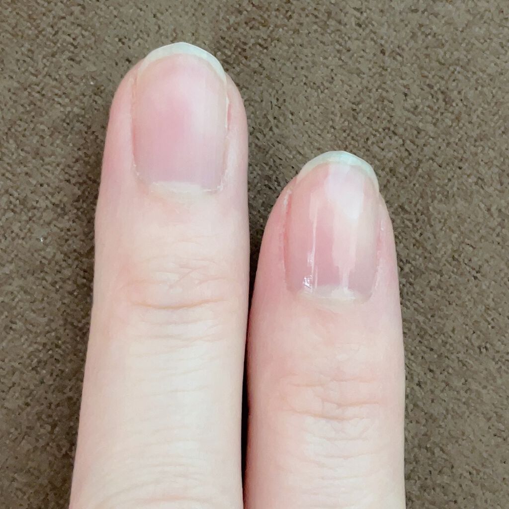 ディーアップファンデーション/D-UP/ネイルベースコートを使ったクチコミ(4枚目)