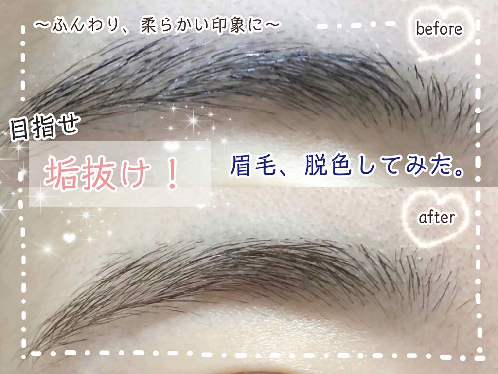 脱色クリーム 敏感肌用/エピラット/ムダ毛ケアを使ったクチコミ(1枚目)