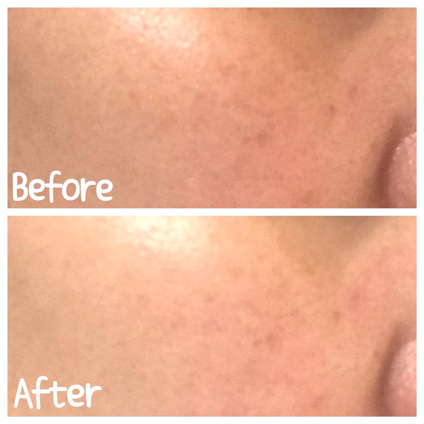 ベビーローション/BELTA(ベルタ)/化粧水を使ったクチコミ（3枚目）