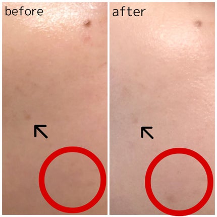 メラノショット ホワイト D/ONE BY KOSE/美容液を使ったクチコミ(5枚目)