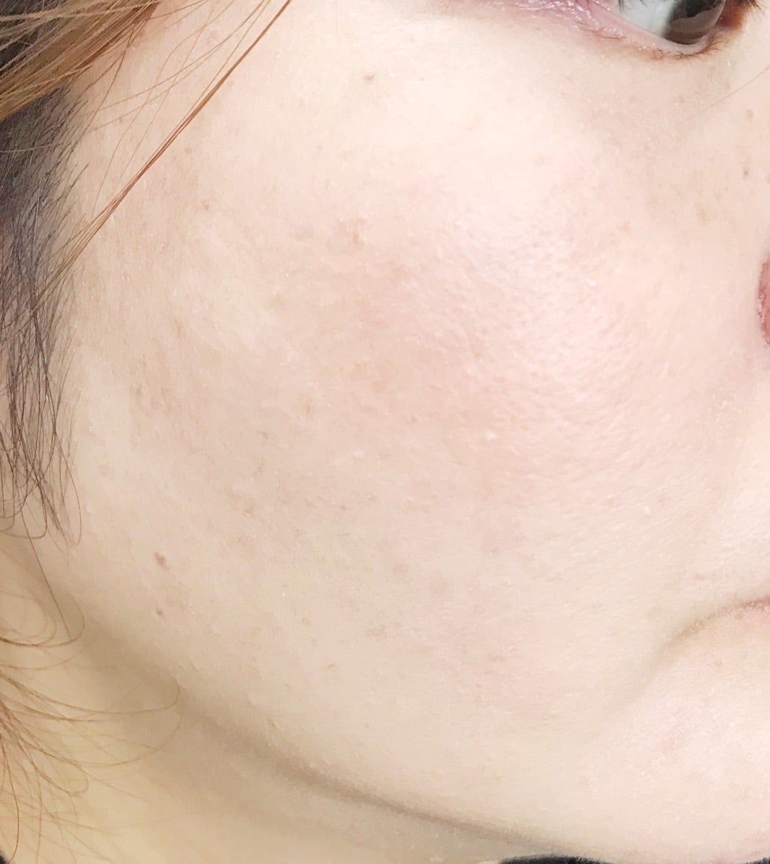 生つやキープミスト/ウルミナプラス/美容液を使ったクチコミ(5枚目)