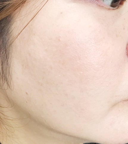 生つやキープミスト/ウルミナプラス/美容液を使ったクチコミ(5枚目)