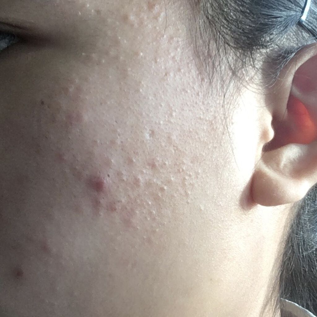 ハトムギ化粧水(ナチュリエ スキンコンディショナー R )/ナチュリエ/化粧水を使ったクチコミ（2枚目）