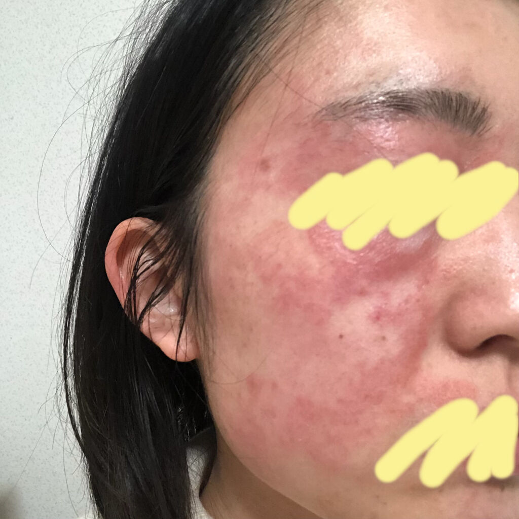 化粧水・敏感肌用・高保湿タイプ/無印良品/化粧水を使ったクチコミ（2枚目）