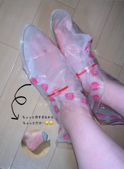 あしやすめ 足裏角質ケアパック/鎌倉ライフ/レッグ・フットケアを使ったクチコミ(3枚目)