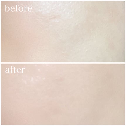 CICA エマルジョン/VT/乳液を使ったクチコミ(8枚目)