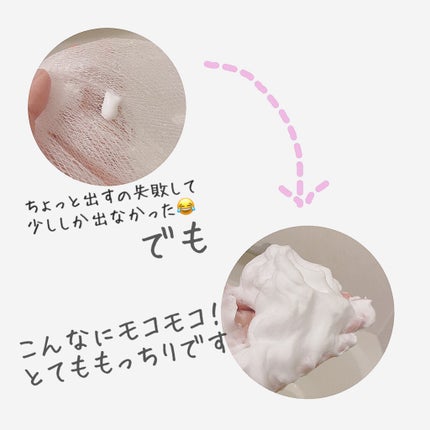 パーフェクトホイップ アクネケア/SENKA(専科)/洗顔フォームを使ったクチコミ(3枚目)