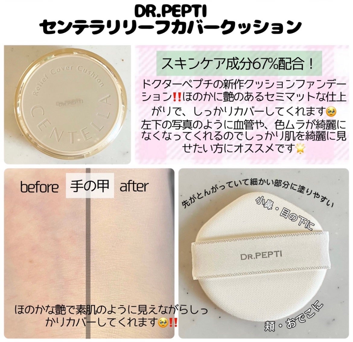 センテラリリーフカバークッション/DR.PEPTI/クッションファンデーションを使ったクチコミ(2枚目)