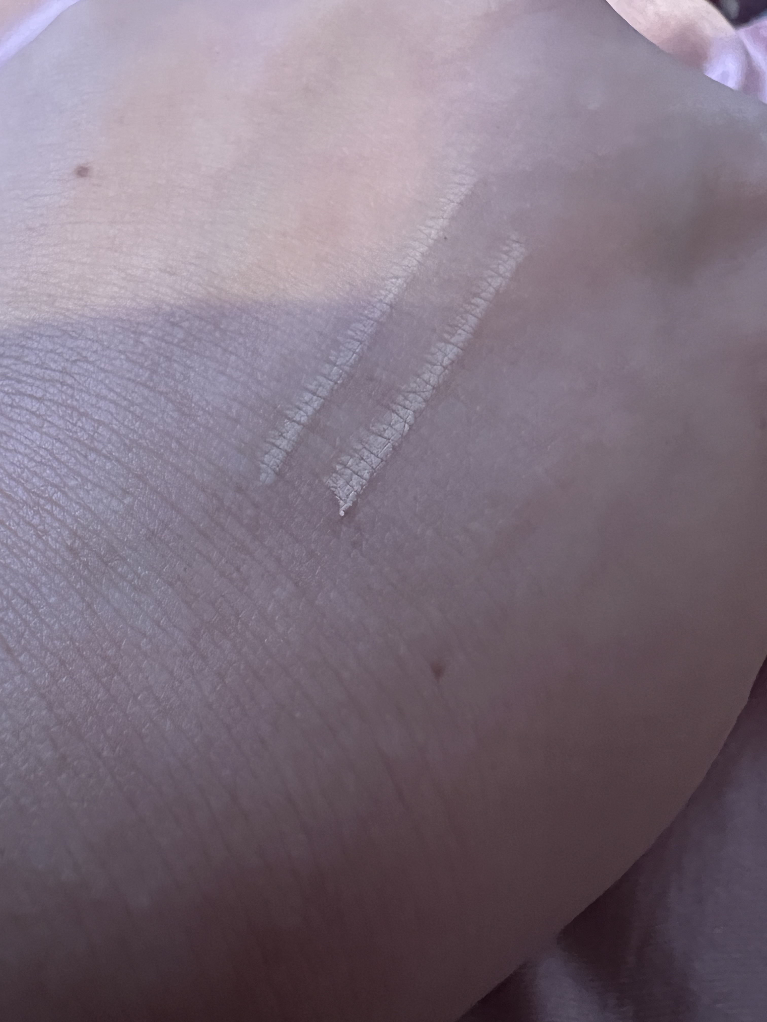 ポイントコンシーラー/CipiCipi/ペンシルコンシーラーを使ったクチコミ（3枚目）