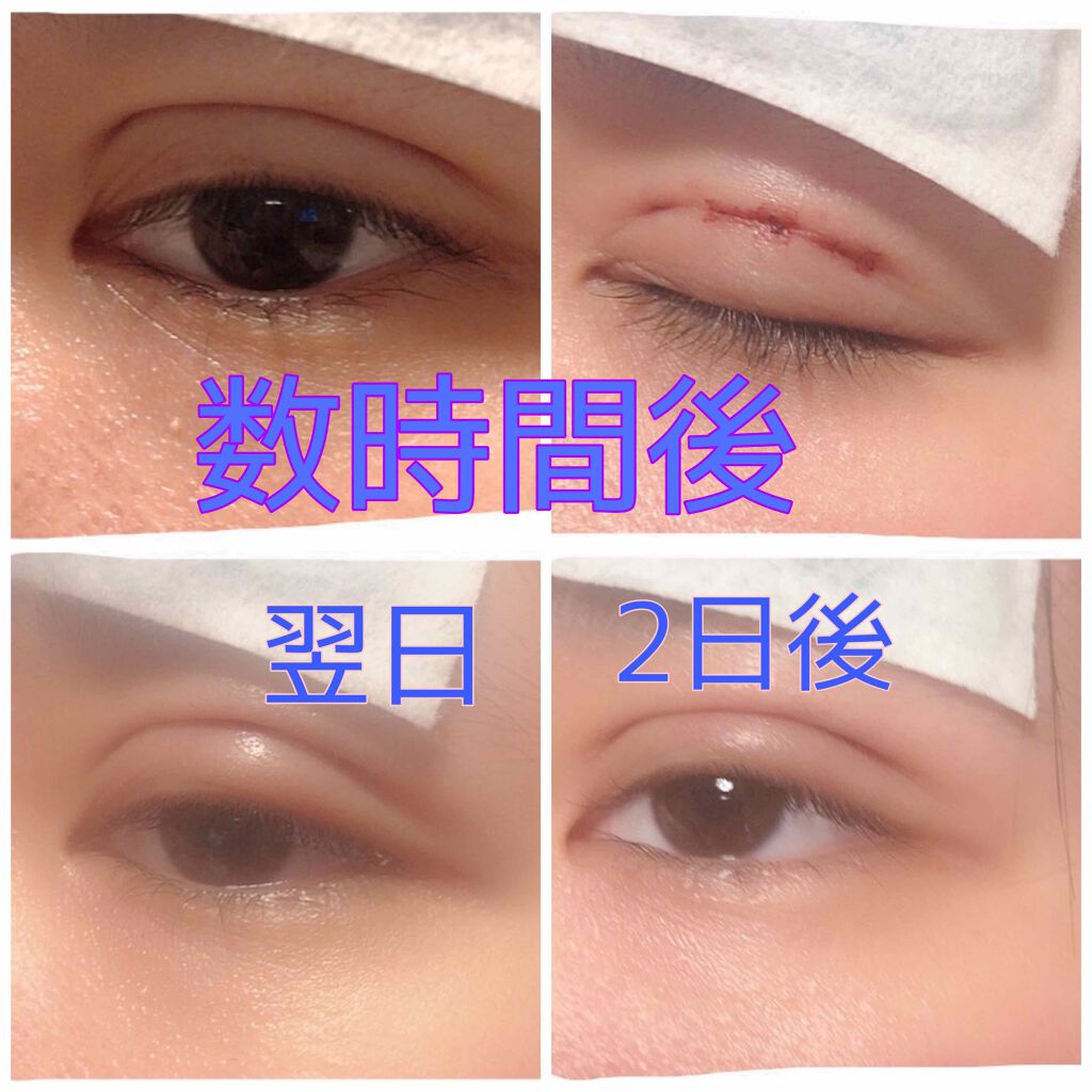 ふ じ り ち ゃ ん on LIPS 「2ヶ月ぶりです🥺ふじりちゃんですーーーーーーーーーーーーーーー..」(2枚目)