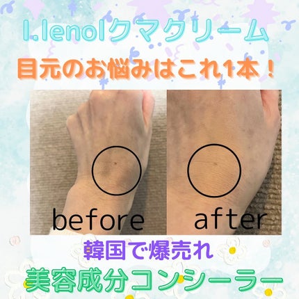 アイレノール クマクリーム/IRENOL/アイケア・アイクリームを使ったクチコミ(3枚目)