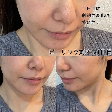 を使ったクチコミ(3枚目)