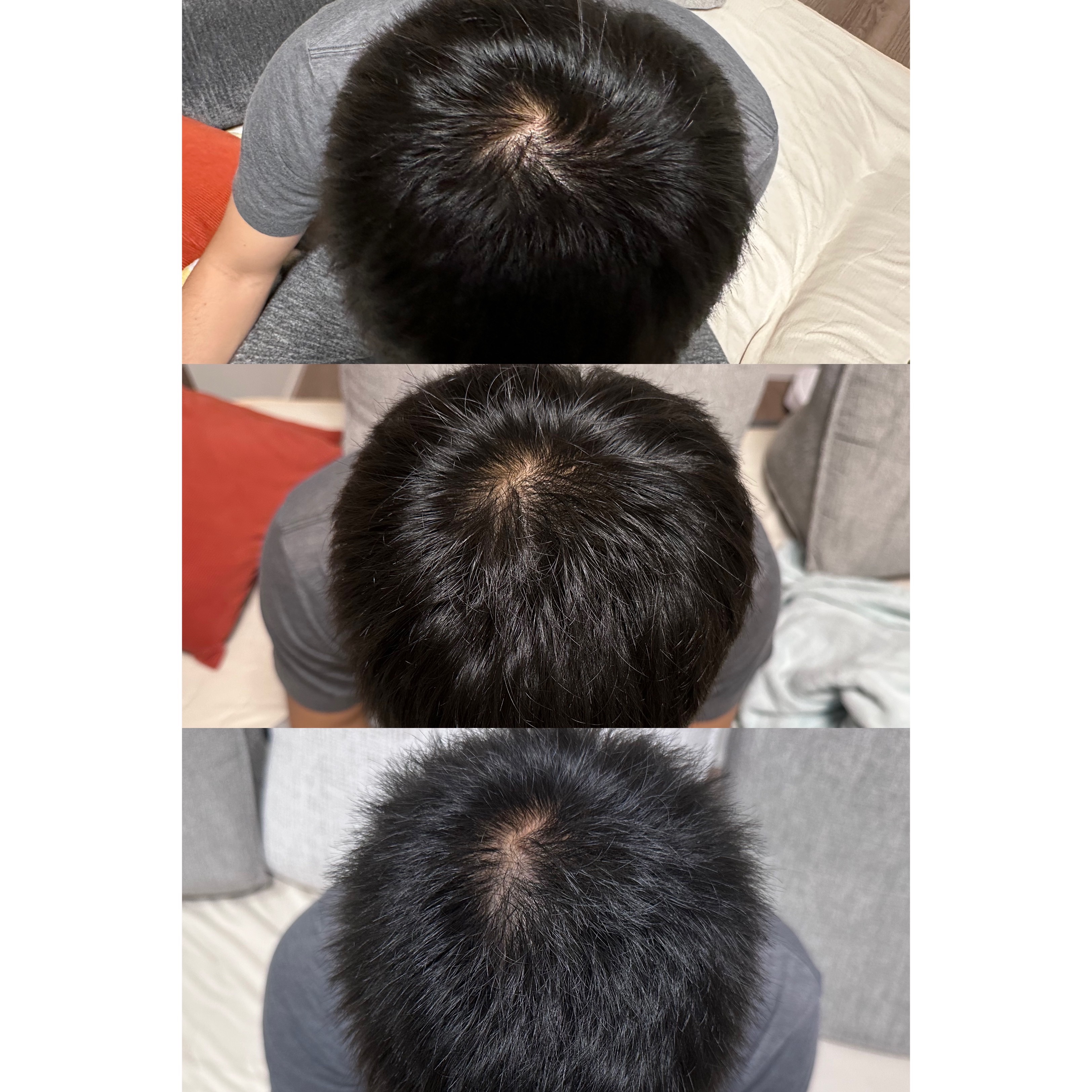 SonoRepro/アンファー(スカルプD)/ヘアケアグッズを使ったクチコミ（2枚目）