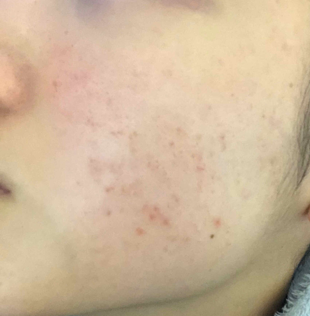 ビジャ シカバーム EX/innisfree/フェイスバームを使ったクチコミ（2枚目）