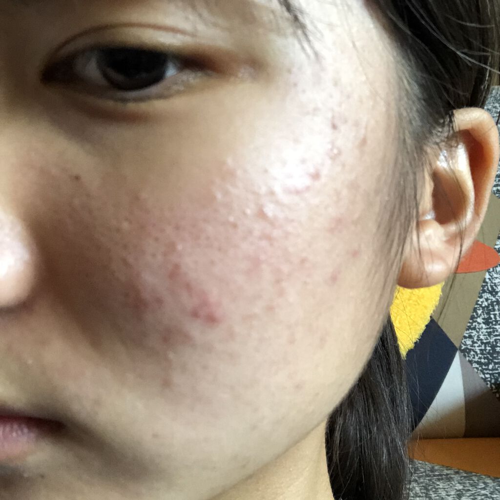 ディープモイスチャースプレー/キュレル/ミスト状化粧水を使ったクチコミ（1枚目）