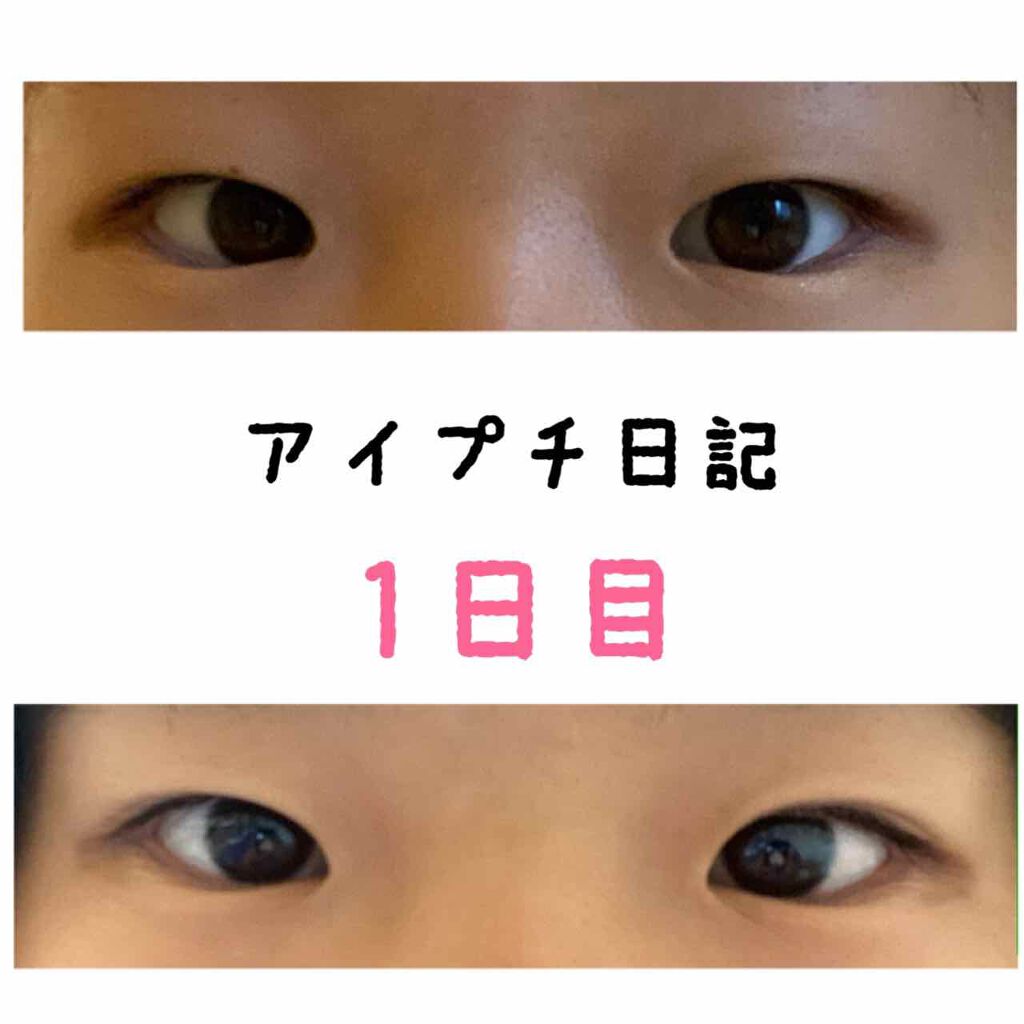 アイビューティー フィクサー WP/アストレア ヴィルゴ/二重まぶた用アイテムを使ったクチコミ(1枚目)
