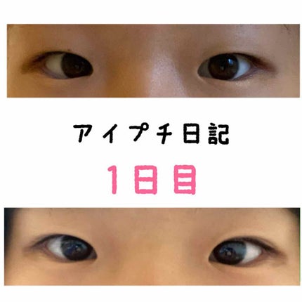 アイビューティー フィクサー WP/アストレア ヴィルゴ/二重まぶた用アイテムを使ったクチコミ(1枚目)