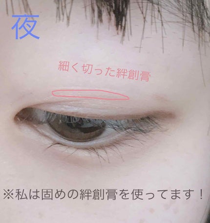 アイビューティー フィクサー WP/アストレア ヴィルゴ/二重まぶた用アイテムを使ったクチコミ(3枚目)