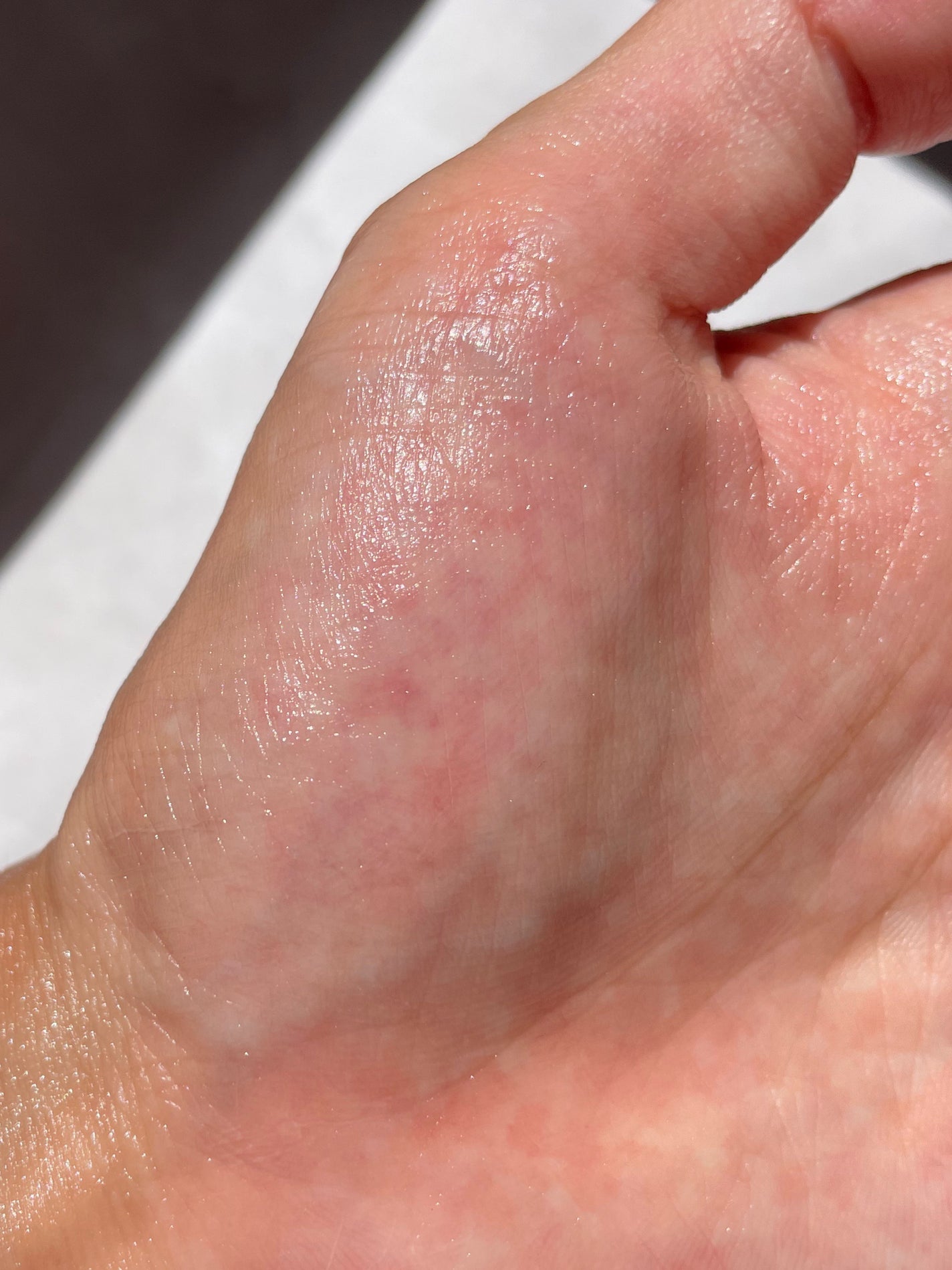 バクシア モイスチャーアップクリーム/White Rush/フェイスクリームを使ったクチコミ(2枚目)