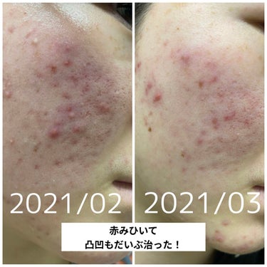 カプセルレシピパック N B＆A/innisfree/洗い流すパック・マスクを使ったクチコミ（2枚目）