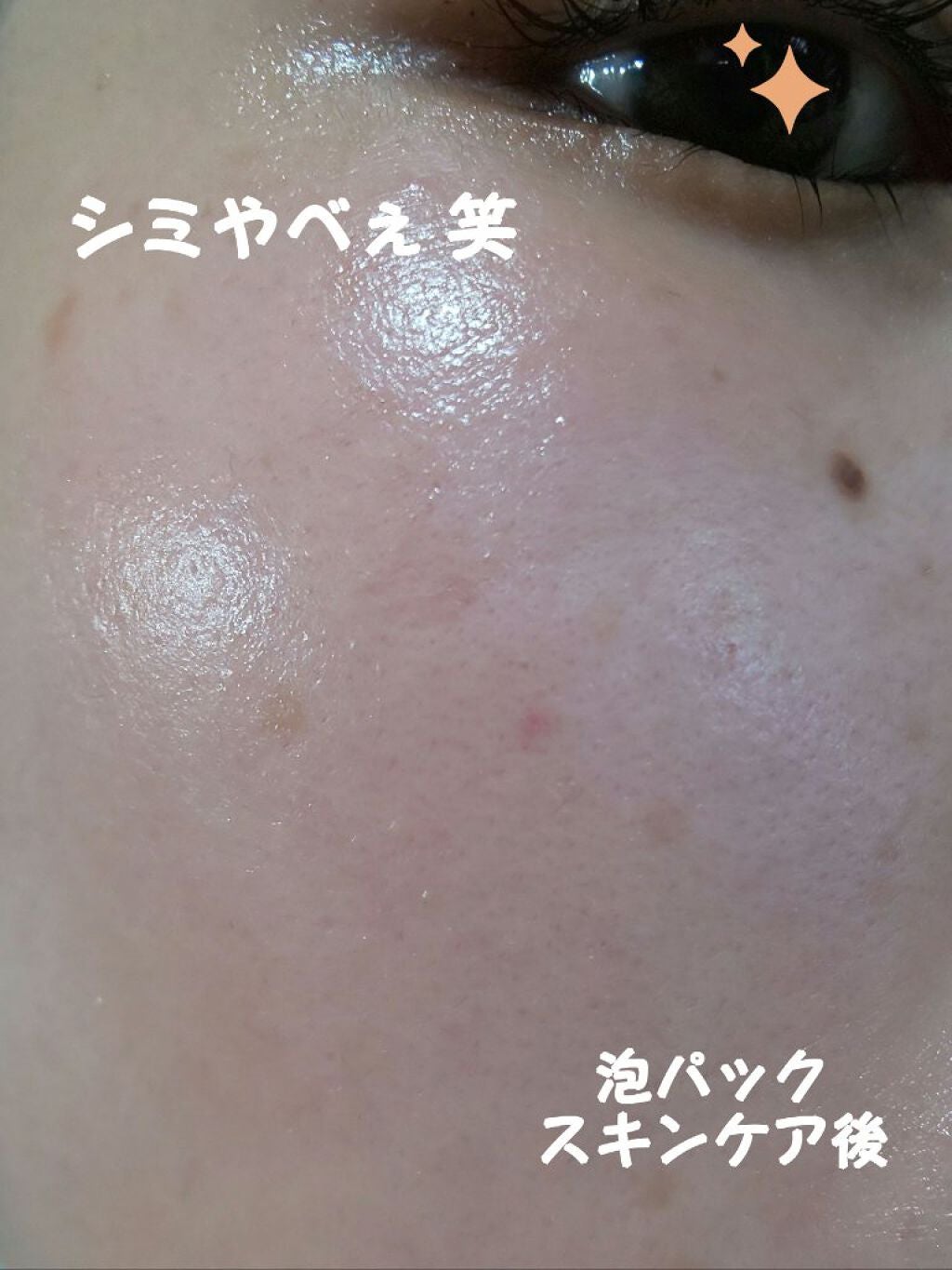 炭酸泡クレンジングパック/piera(ピエラ)/洗い流すパック・マスクを使ったクチコミ(3枚目)