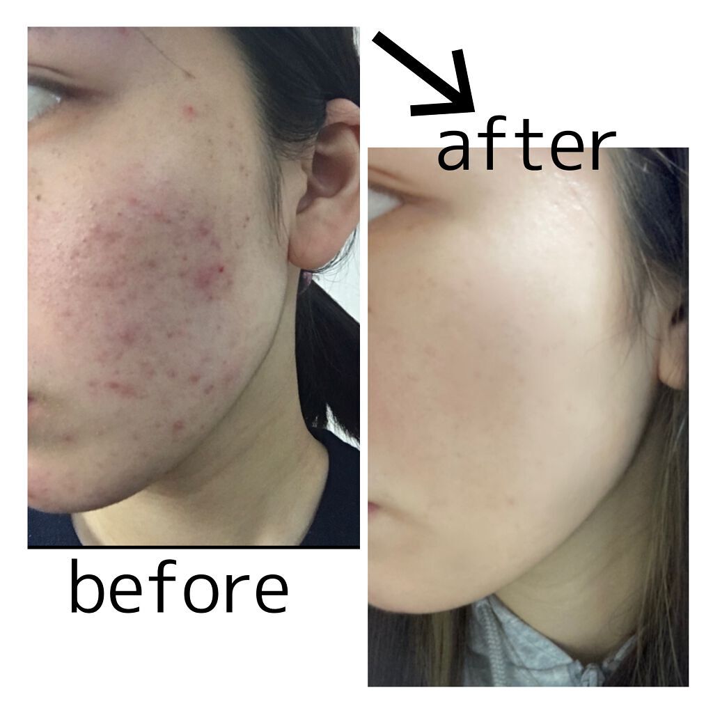 なめらか本舗 乳液 NA/なめらか本舗/乳液を使ったクチコミ（1枚目）