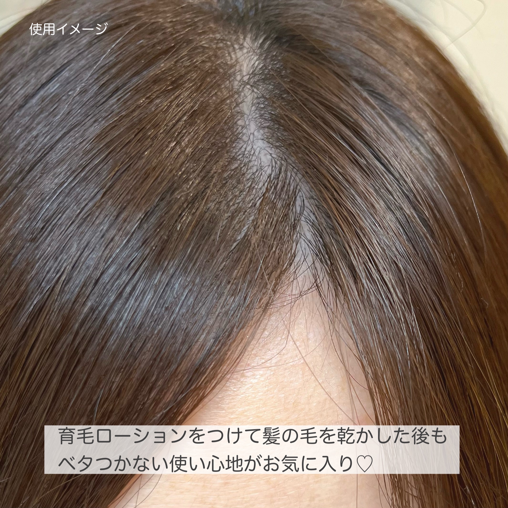 モルティ 薬用育毛ローション/モウガL/頭皮ローションを使ったクチコミ（3枚目）