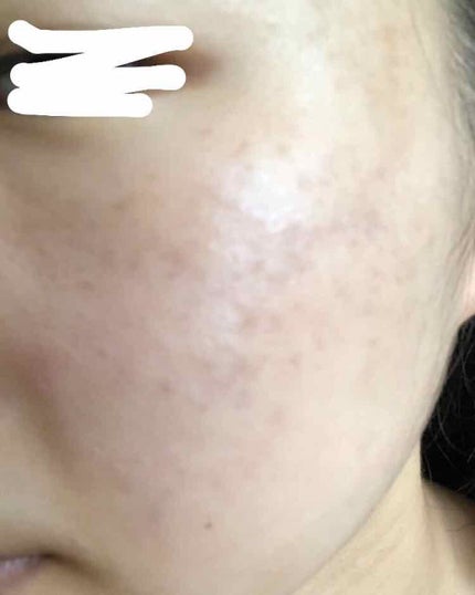 ユースキンS UVミルク/ユースキンS/日焼け止め・UVケアを使ったクチコミ(2枚目)