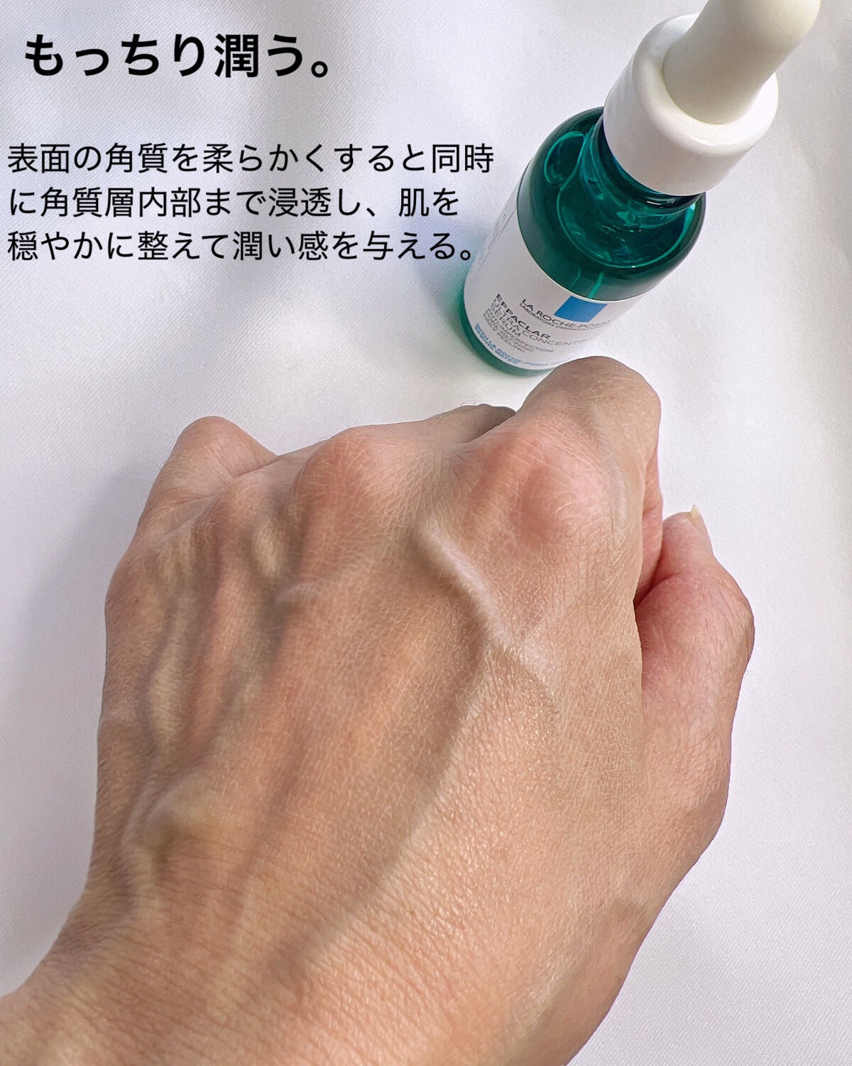 エファクラ ピールケア セラム/ラ ロッシュ ポゼ/美容液を使ったクチコミ(5枚目)