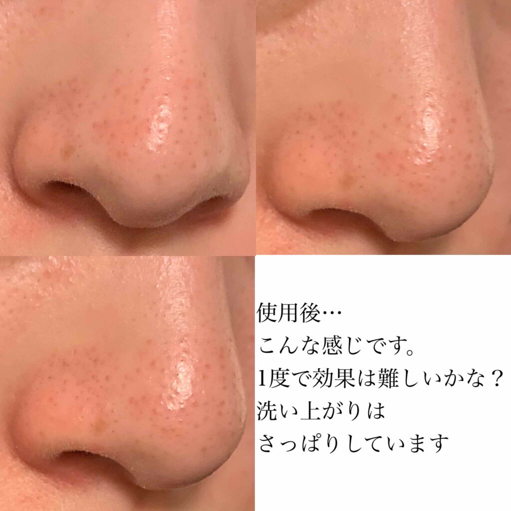 バブルクレイパック/イエスパ/洗い流すパック・マスクを使ったクチコミ(4枚目)