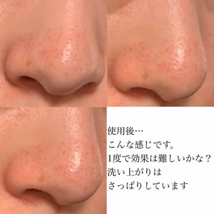 バブルクレイパック/イエスパ/洗い流すパック・マスクを使ったクチコミ(4枚目)