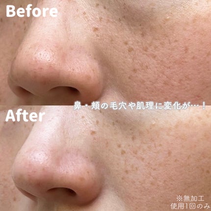 REAL CICA PEEL OFF PACK/Aetem /シートマスク・パックを使ったクチコミ(3枚目)