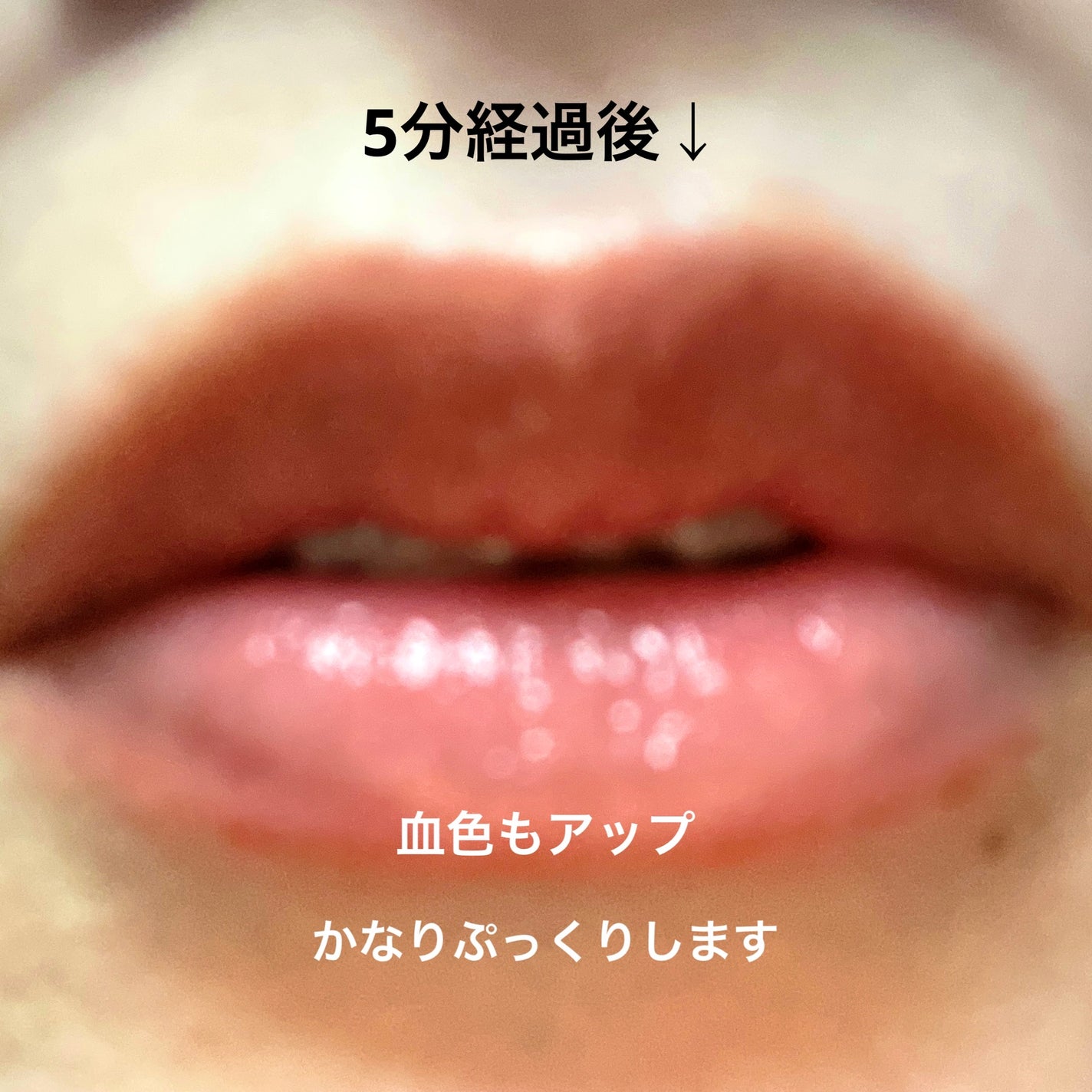 マッドピーチウォータートックスリッププランパー/MAD PEACH/リッププランパーを使ったクチコミ(4枚目)