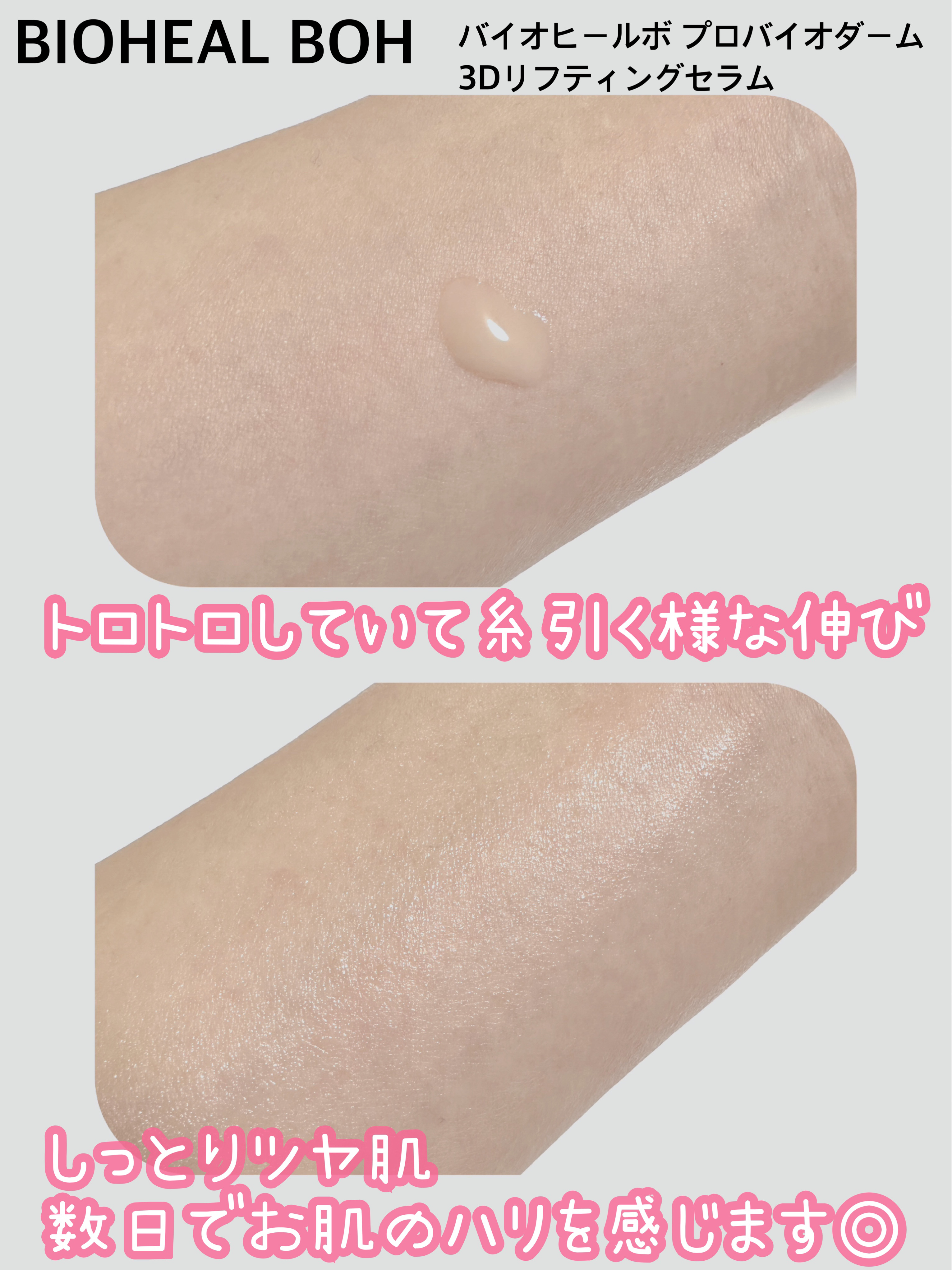 バイオヒールボ プロバイオダーム 3Dリフティングセラム/BIOHEAL BOH/美容液を使ったクチコミ（2枚目）