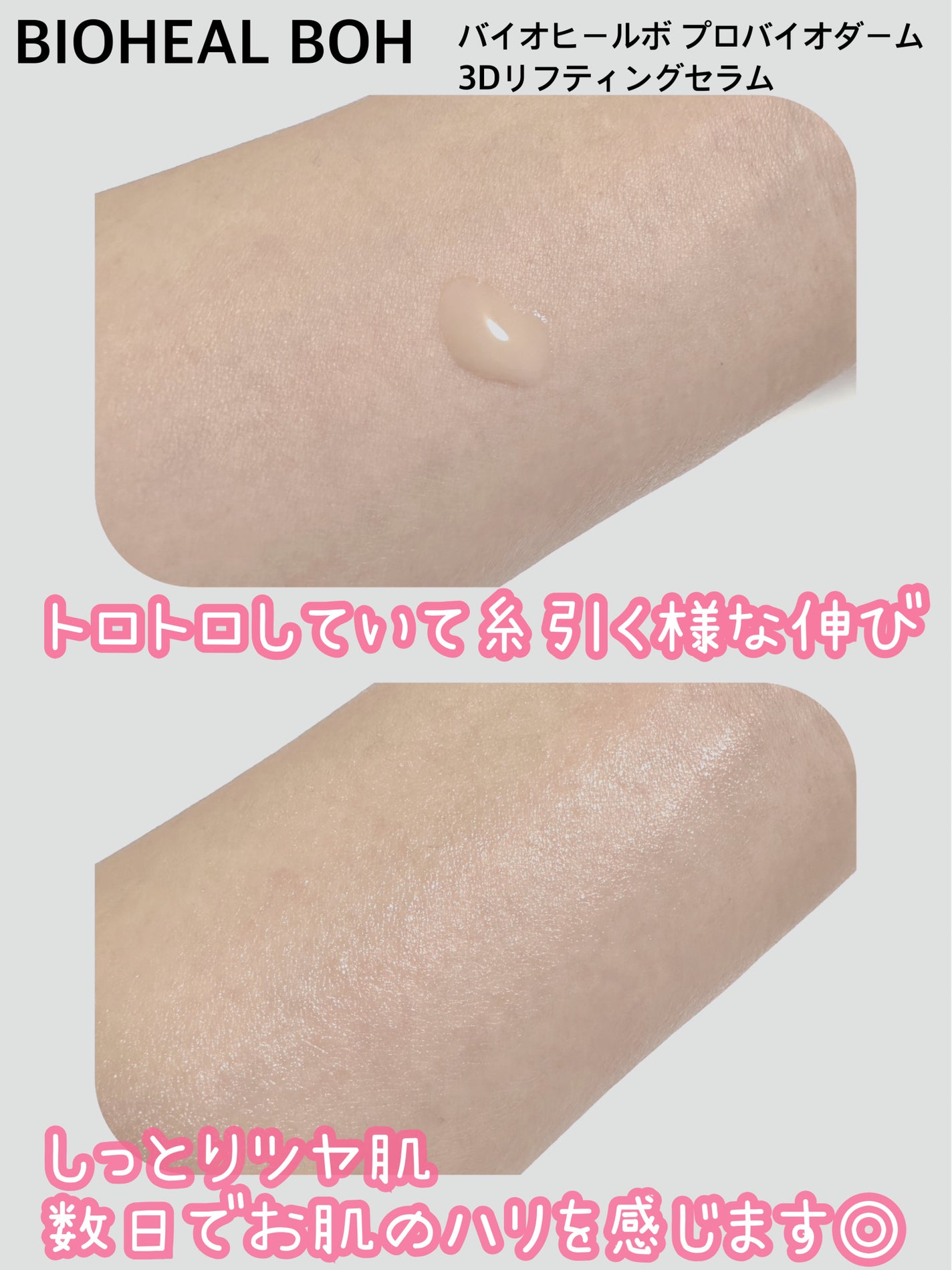 バイオヒールボ プロバイオダーム 3Dリフティングセラム/BIOHEAL BOH/美容液を使ったクチコミ(2枚目)