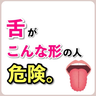 あなたの肌に合ったスキンケア💐コーくん on LIPS 「【あてはまったらヤバい。】舌がこんな形の人は危険です。..あな..」（1枚目）