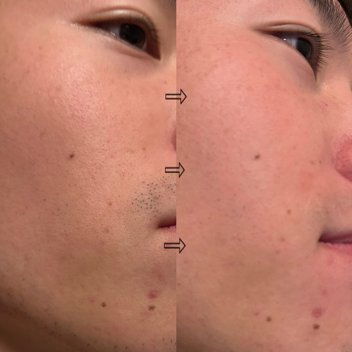 easy ハイブリッド ジェルフォーム シトラスウッドの香り/MARO/ムダ毛ケアを使ったクチコミ（3枚目）