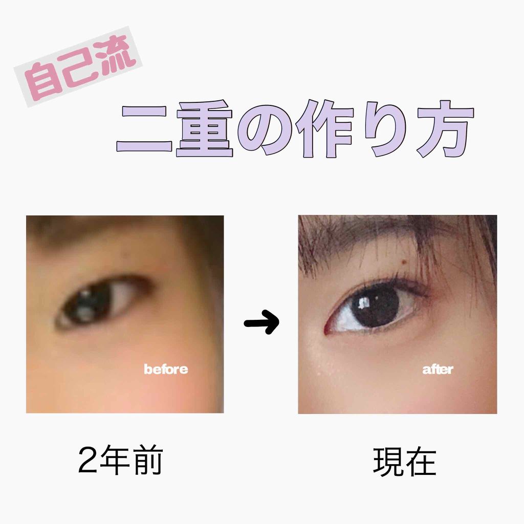 のびーるアイテープ（絆創膏タイプ、レギュラー）/DAISO/二重まぶた用アイテムを使ったクチコミ（1枚目）