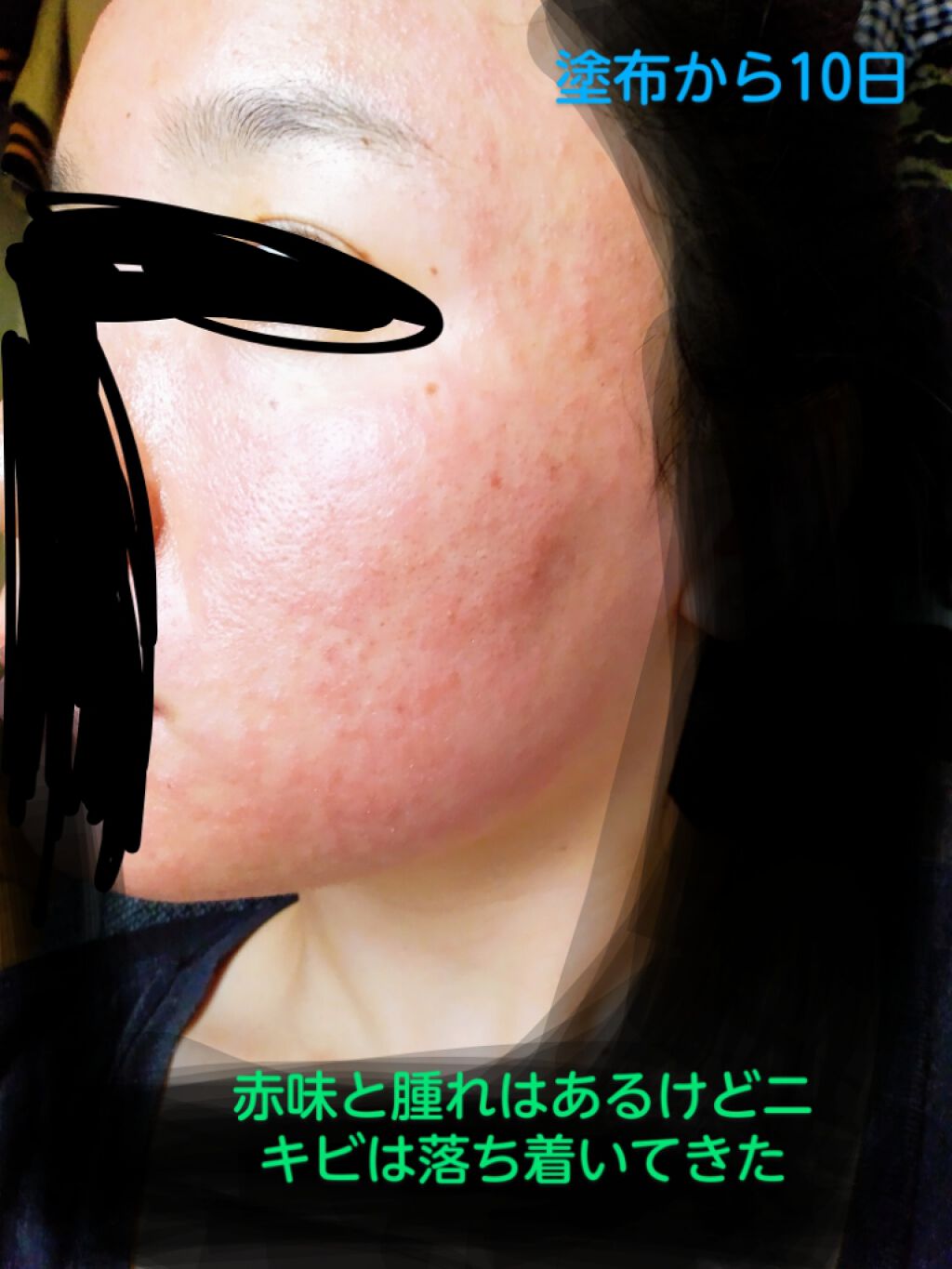 日本酒の化粧水/菊正宗/化粧水を使ったクチコミ(3枚目)