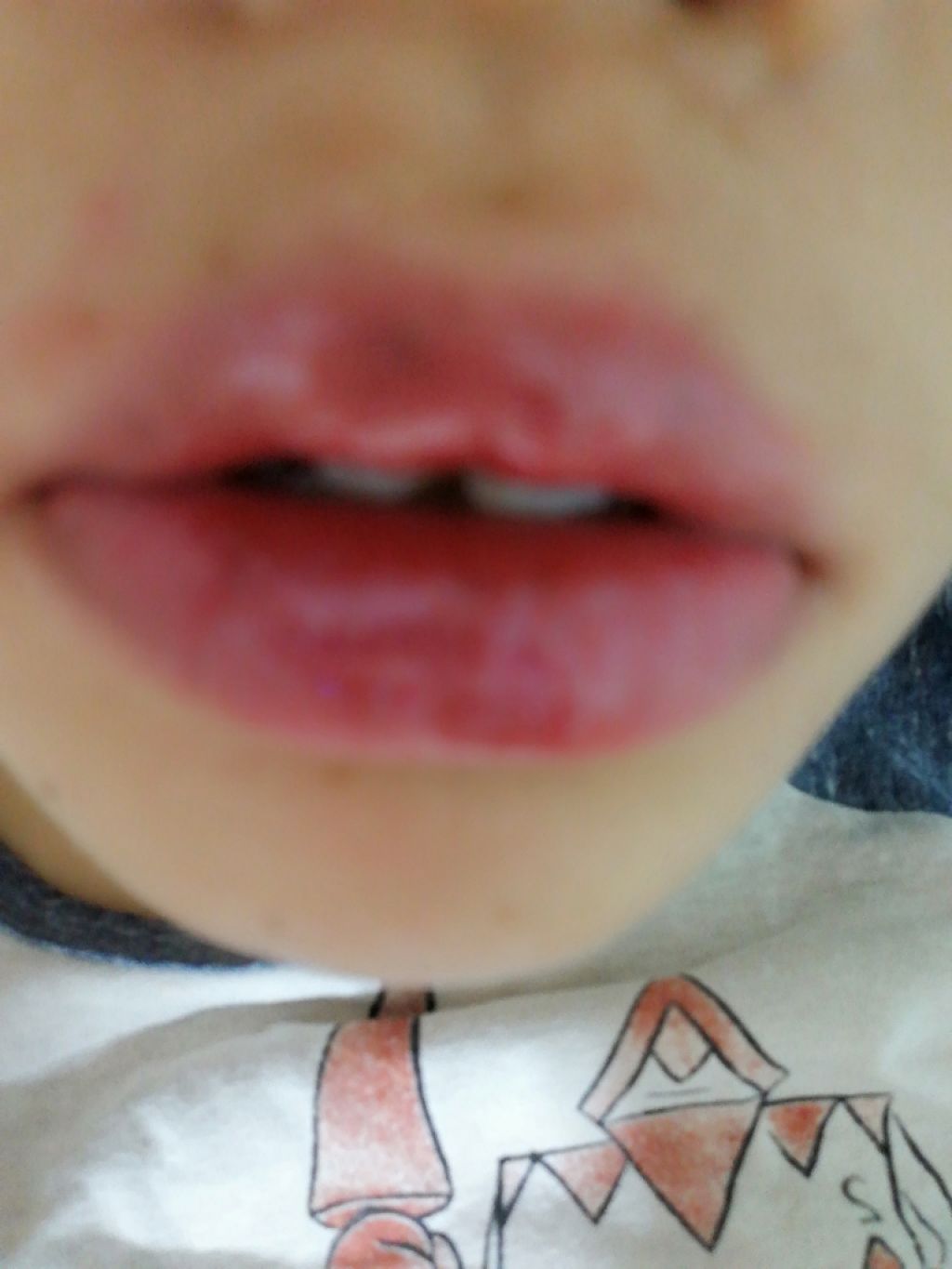 MP ジェム リップグロス/セリア/リップグロスを使ったクチコミ（2枚目）