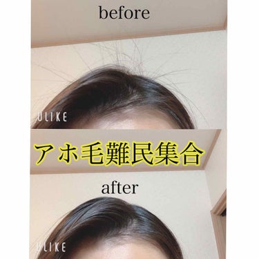 あほ毛って本当に、嫌になりますよね😖


あまり自分では気にしていなかったのですが、今日アホ毛すごいねと毎日学校で言われるようになり、さすがにどうしようか悩んでいました。😅


 写真やプリクラを撮って