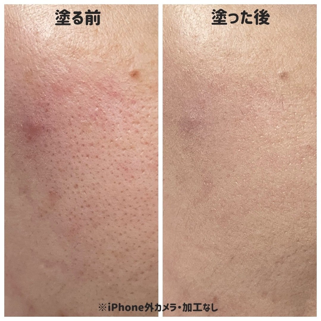 ããããð¿éåœã³ã¹ã¡ on LIPS ã.â1é±éã®æ±äº¬åºåŒµã«æã£ãŠãã£ãã¯ãã·ã§ã³ãã¡ã³ãïŒä»ããã..ãïŒ5æç®ïŒ