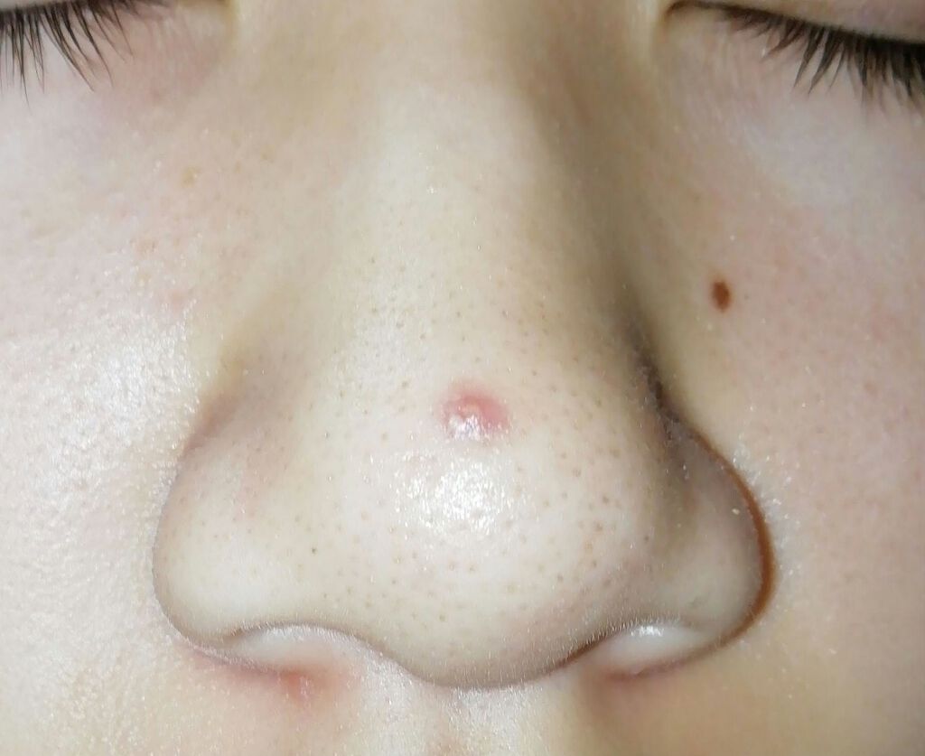 極潤 ヒアルロン液 ライトタイプ/肌ラボ/化粧水を使ったクチコミ（2枚目）