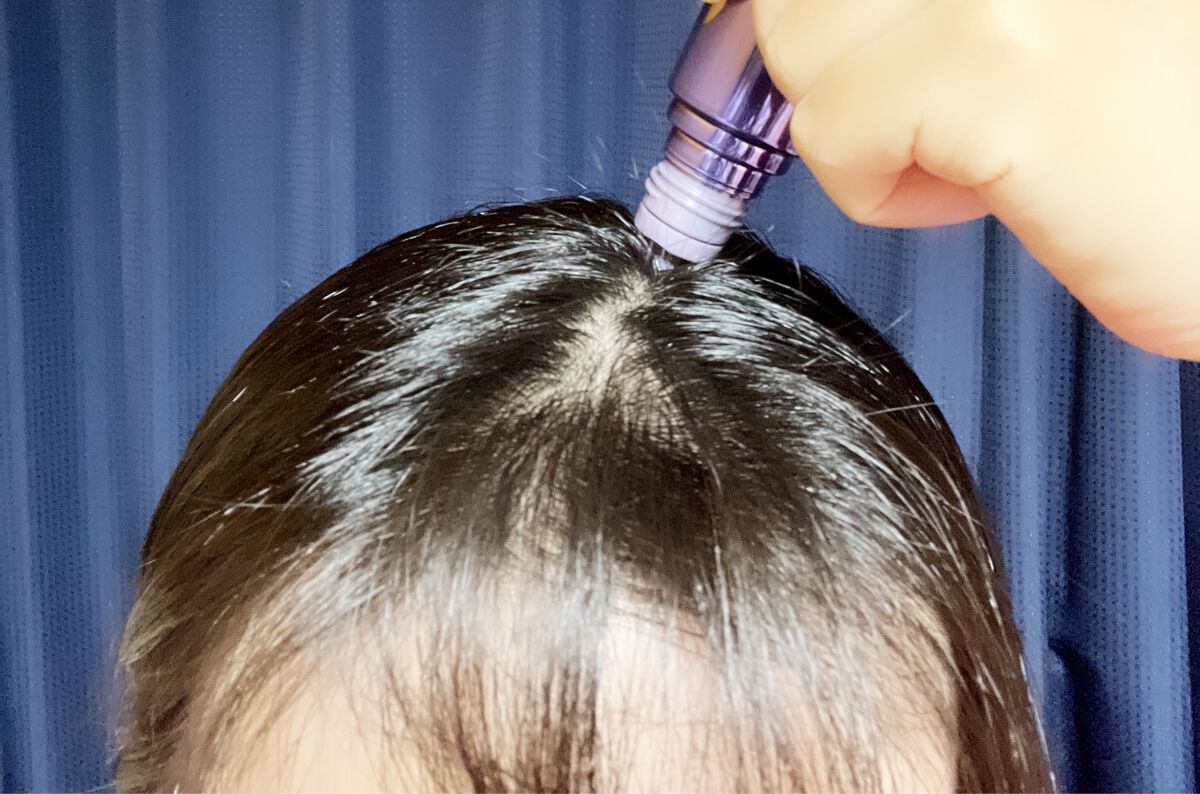 ヘアリッチローション/リソウコーポレーション/頭皮ローションを使ったクチコミ（3枚目）