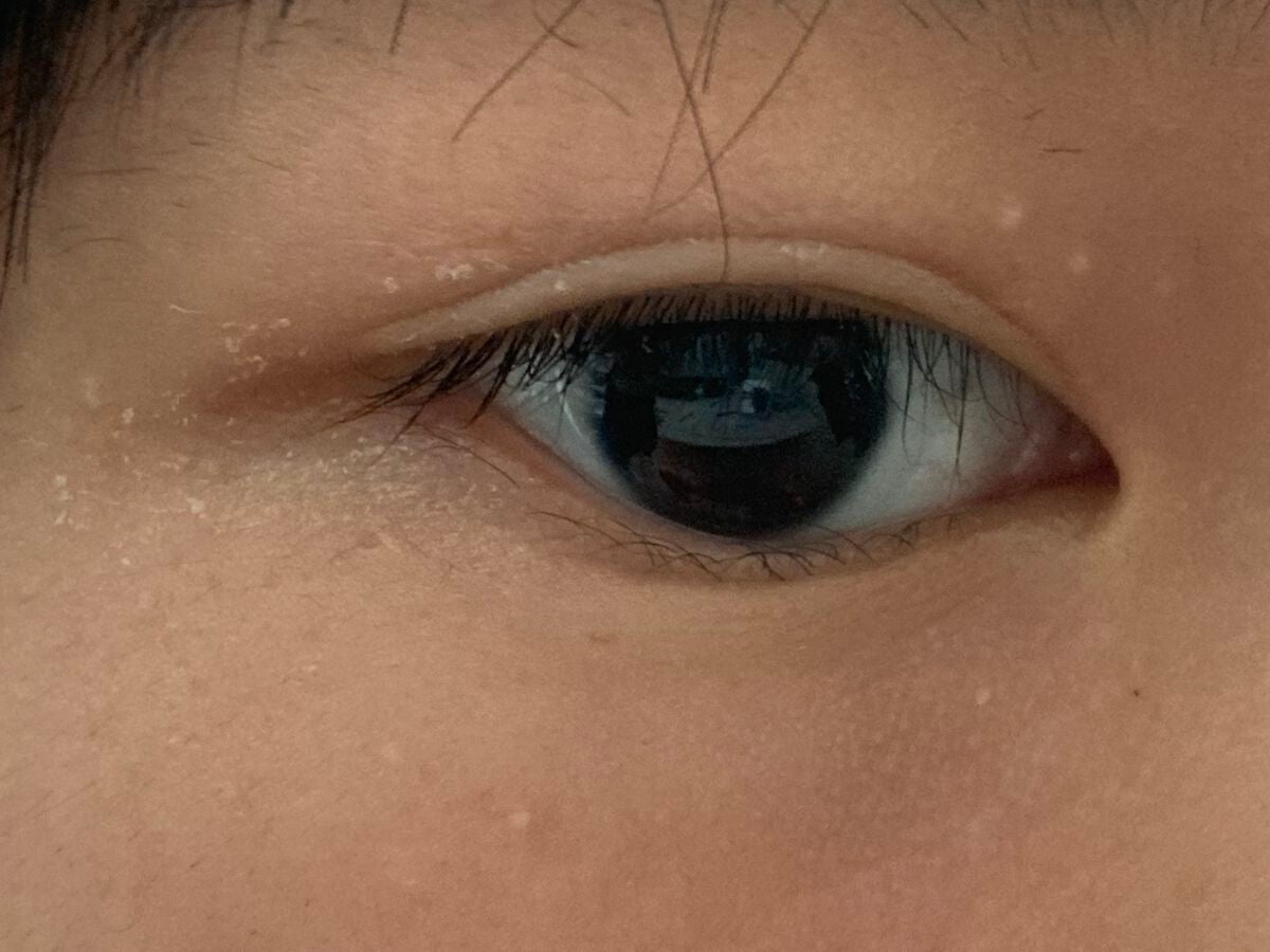 coral_perfume_n6f7 on LIPS 「ダイソーのアイプチをやるとこうなりますなのであまりおすすめはで..」(1枚目)