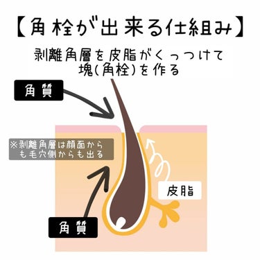 敏感肌な研究者💊あすか💊 on LIPS 「今回は#ダイエットがはからずも#ニキビケアになった経緯を、詳細..」（3枚目）