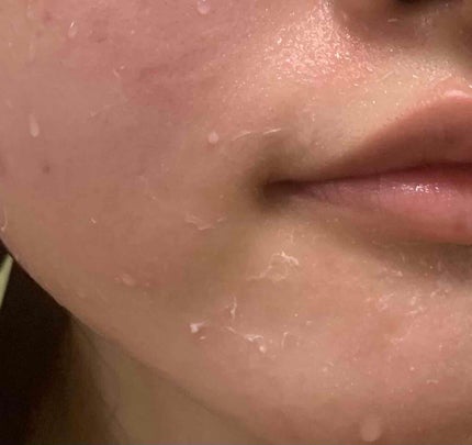 レチノールA 1% アドバンスドリバイタリゼーションクリーム/Life-flo/フェイスクリームを使ったクチコミ(3枚目)